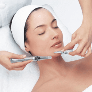 پاکسازی پوست با میکرودرم