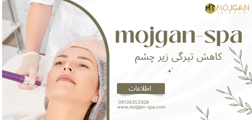 کاهش تیرگی زیر چشم - مزوتراپی صورت
