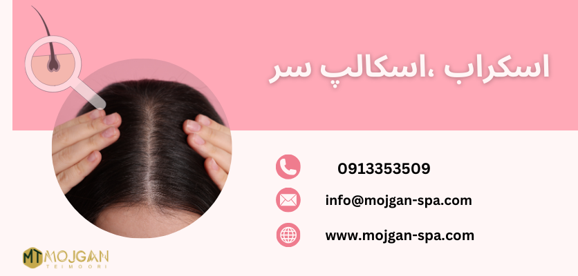 مدیریت جوش - جوش کف سر