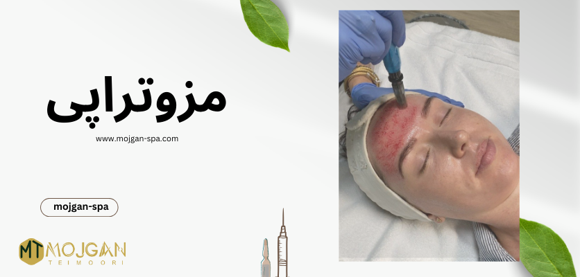 مزوتراپی - مراقبت های مزوتراپی