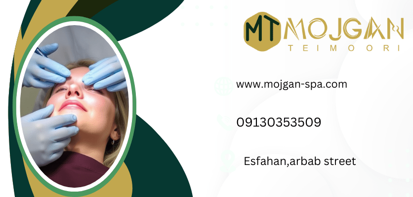 آندولیفت-آندولیفت
