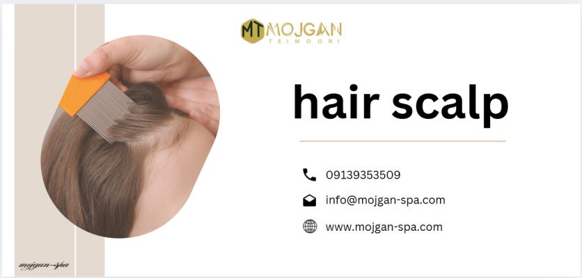 سلامت پوست سر - شپش سر