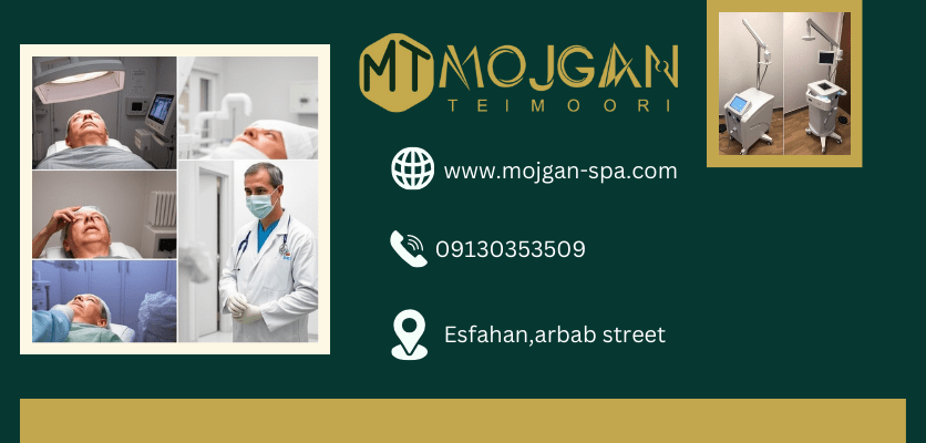 نحوه کار-آندولیفت