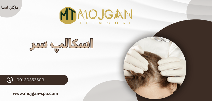 علل ایجاد - پسوریازیس سر