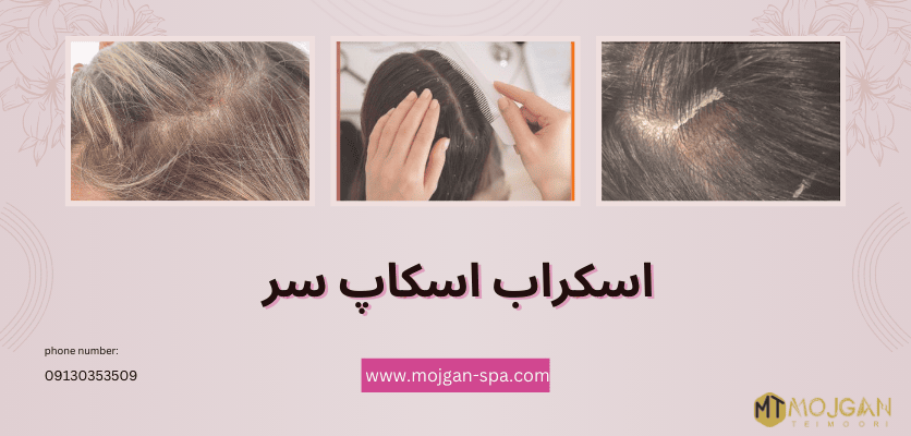 اسکراب سر - انواع پوست سر