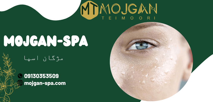 آبرسانی - هیدرودرمی