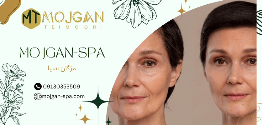 تاثیرات مزوژل - تزریق مزوژل