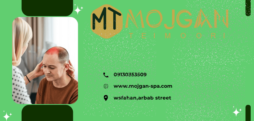 قرمزی کف سر-قرمزی کف سر